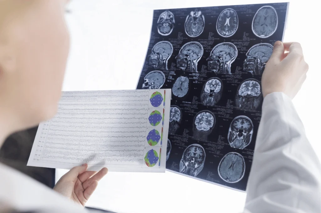 Surgeon reading cranial images